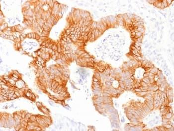 EPCAM Antibody (clone EGP40/1798, Azide-free, BSA-free)