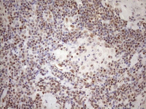 MGMT Antibody (clone OTI6C4, Carrier-free)