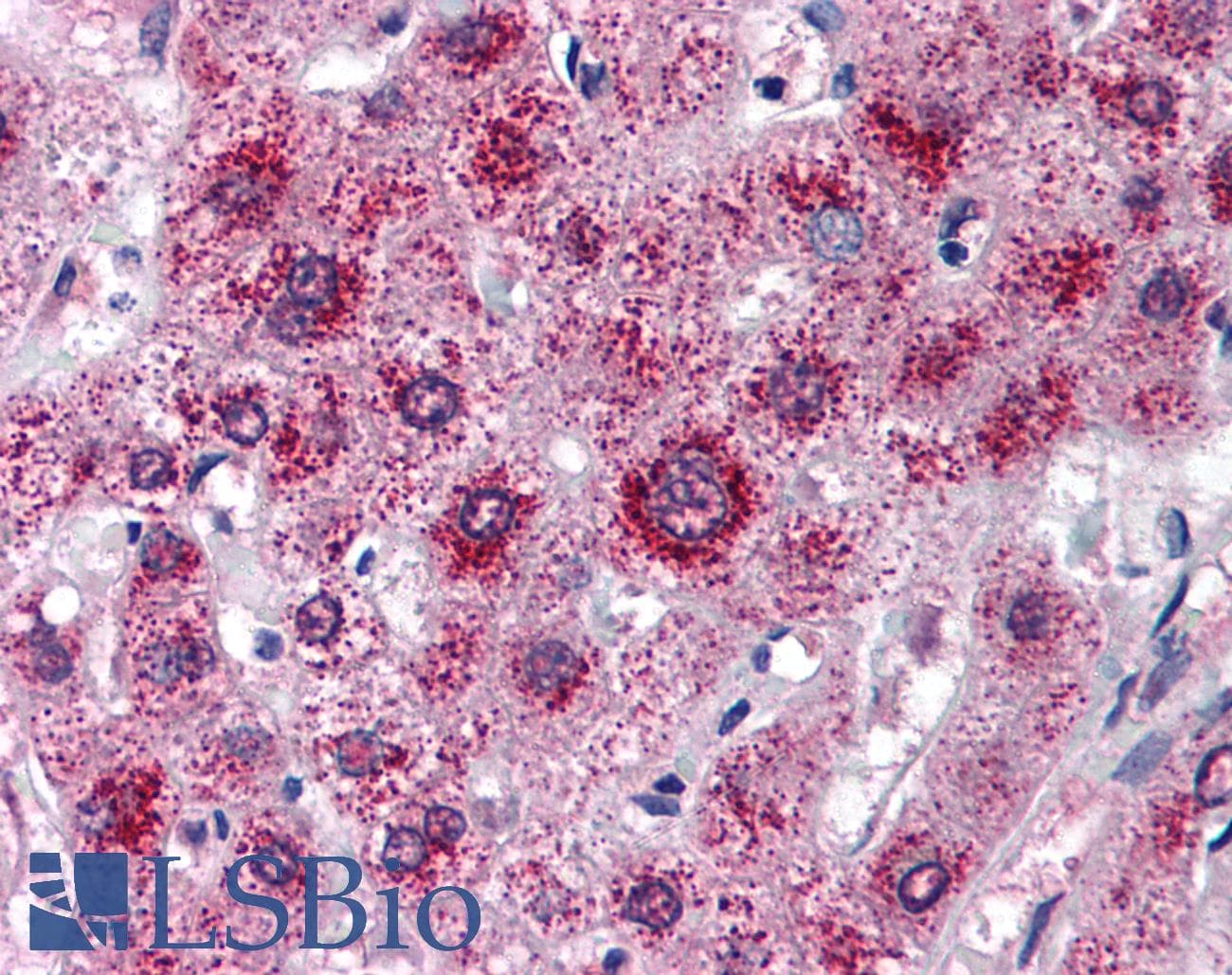 IHC-plus™ LDLR / LDL Receptor Antibody (aa499-511)