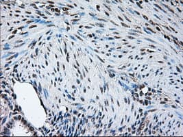 BRAF / B-Raf Antibody (clone OTI1G8)