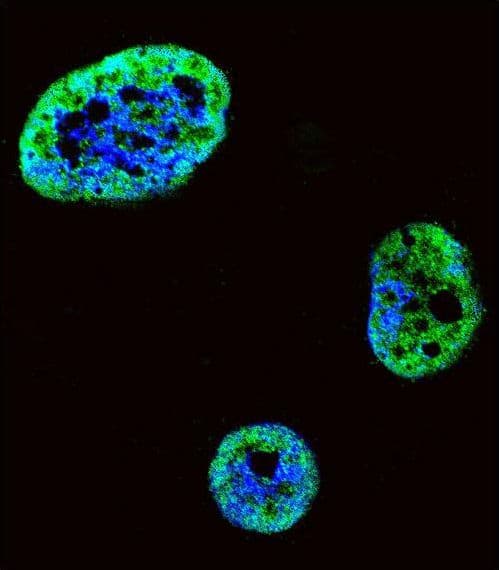 HDGF Antibody (aa171-197)