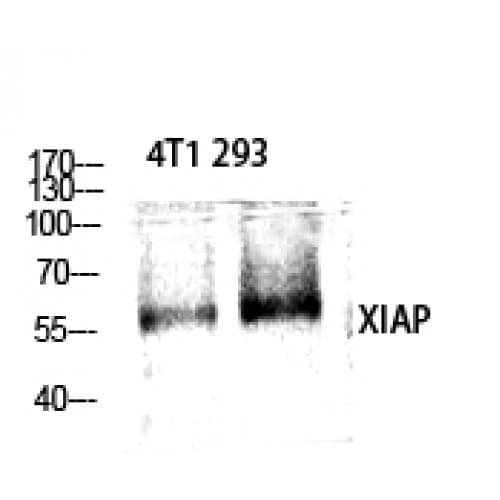 Polyclonal Rabbit anti-Human XIAP Antibody (30-110 aa, IHC, WB)
