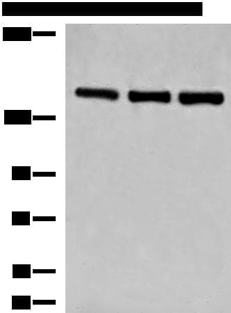 Polyclonal Rabbit anti-Human LPIN1 / Lipin 1 Antibody (IHC, WB)
