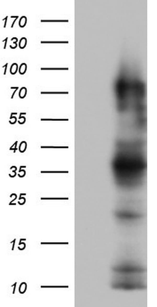 CEACAM5 / CD66e Antibody (aa35-680, clone OTI1D4)