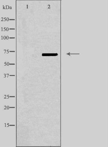 ABCD4 Antibody