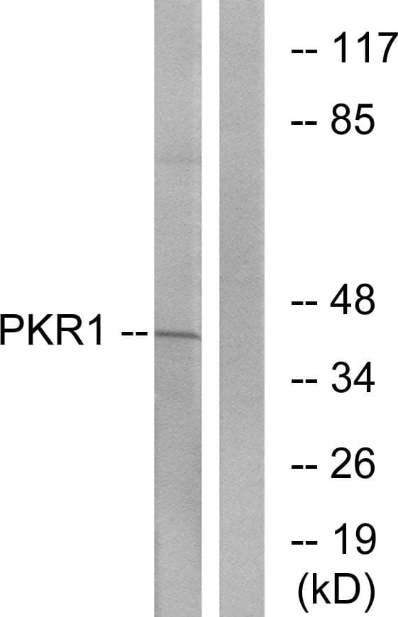 PROKR1 Antibody