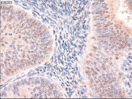 PTCH1 / Patched 1 Antibody (clone OTI5C7)