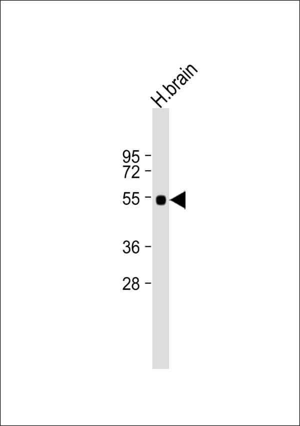 Polyclonal Rabbit anti-Human ARHGEF3 / XPLN Antibody (WB)