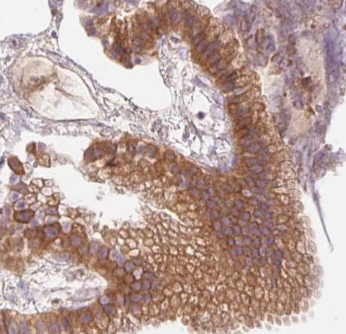 PRKAA1 / AMPK Alpha 1 Antibody
