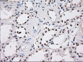 Monoclonal Mouse anti-Human FH / Fumarase / MCL Antibody (clone OTI1F10, IHC, IF, WB)