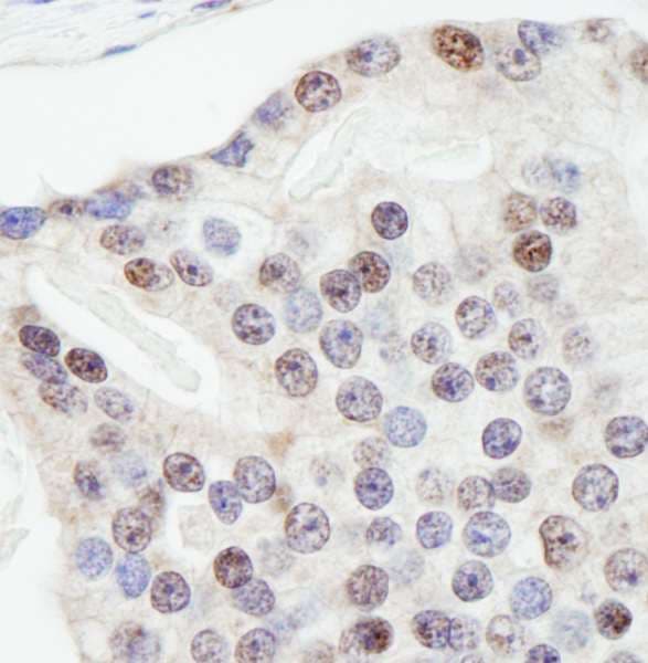 ZNF106 / ZFP106 Antibody (aa1833-1883)