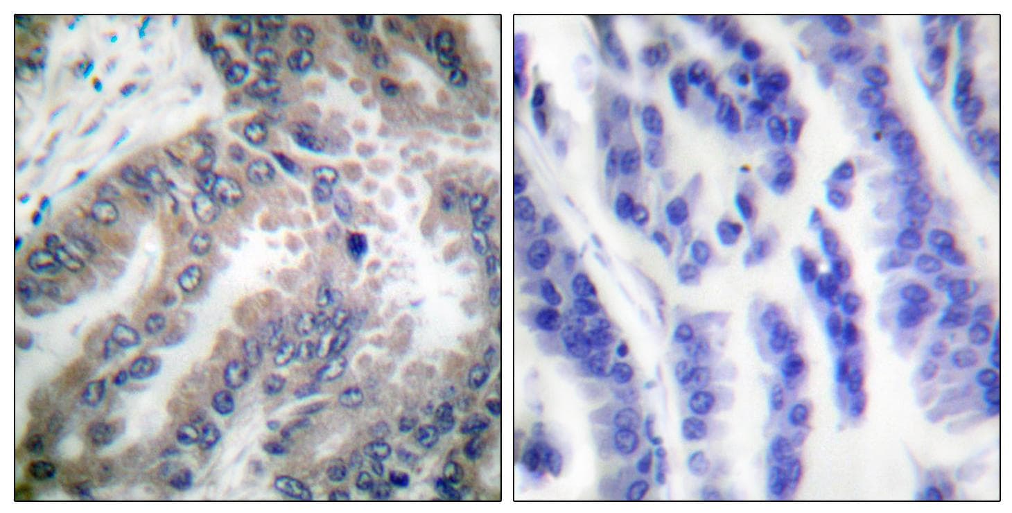 CASP8 / Caspase 8 Antibody (p347)