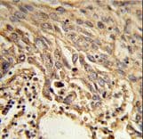EIF4A2 Antibody (aa333-360)