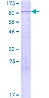 Human HSET / KIFC1 Protein (Recombinant GST)