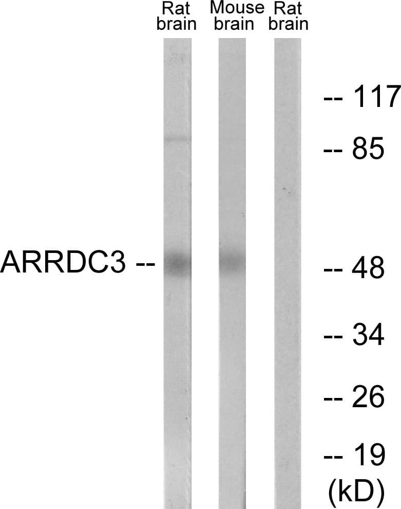 IHC-plus™ Polyclonal Rabbit anti-Human ARRDC3 Antibody (aa365-414, IHC, WB)