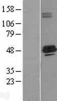 Human SCAD / ACADS Protein (Over-Expression Lysate Myc-DDK (Flag))
