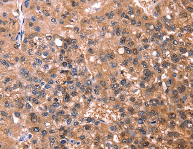 ESRRB / ERR Beta Antibody