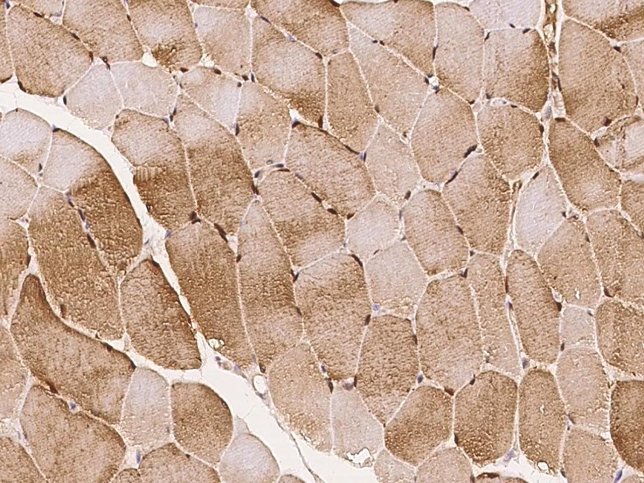 LMCD1 Antibody