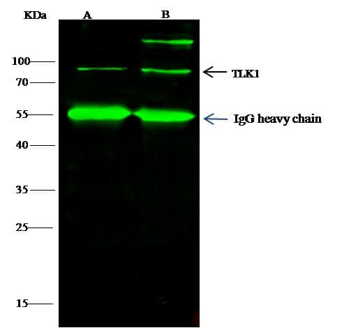 Polyclonal Rabbit anti-Human TLK1 Antibody (Preservative Free, IF, WB)