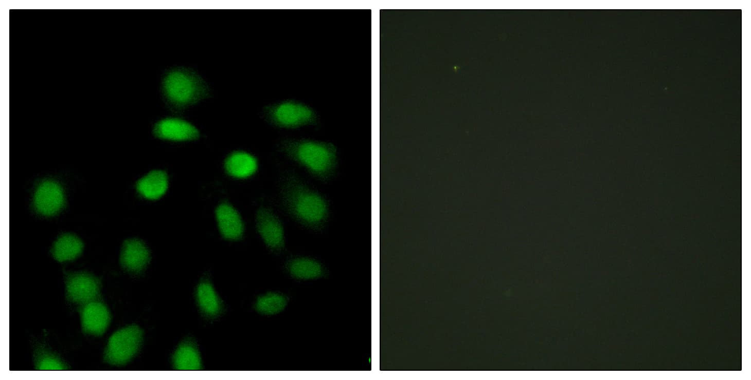 SCAND1 Antibody (aa61-110)