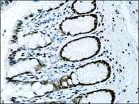 Histone H3 Antibody (aa100-150)