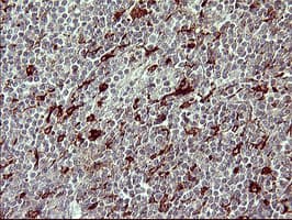 MMP13 Antibody (aa104-471, clone OTI2A6)