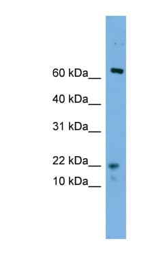 Polyclonal Rabbit anti-Human YPEL5 Antibody (N-Terminus, WB)