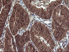VHL / Von Hippel Lindau Antibody (clone OTI1E1)