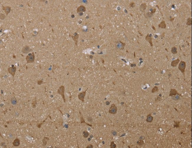 PTK2B / PYK2 Antibody