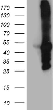 Monoclonal Mouse anti-Human MYBPC2 Antibody (clone OTI2E1, Carrier-free, WB)