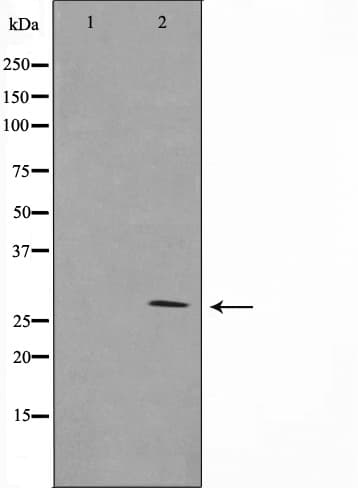 Polyclonal Rabbit anti-Human YWHAZ / 14-3-3 Zeta Antibody (IF, WB)