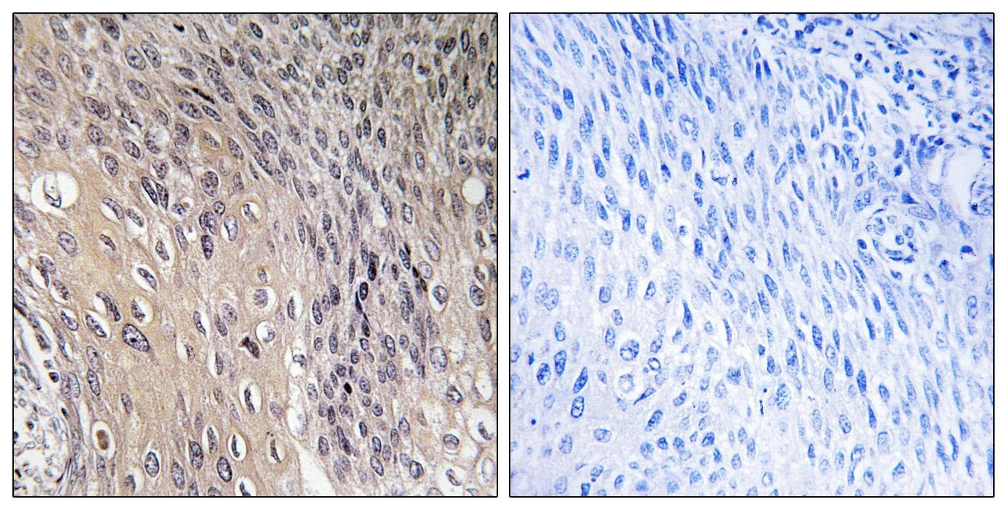 ARHGDIA / RHOGDI Antibody (phospho-Ser174)