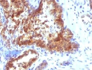 KLK3 / PSA Antibody (clone KLK3/1248)