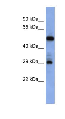 FOLR1 / Folate Receptor Alpha Antibody (aa179-228)