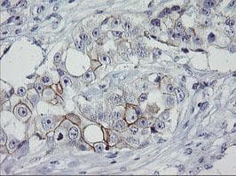 Monoclonal Mouse anti-Human ERBB2 / HER2 Antibody (clone OTI6F3, Carrier-free, aa676-1255, IHC, IF, WB)