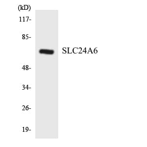 Polyclonal Rabbit anti-Human SLC8B1 / SLC24A6 / NCLX Antibody (aa476-525, WB)