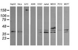 MAP2K3 / MEK3 / MKK3 Antibody (clone OTI5C4, Carrier-free)