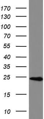 Monoclonal Mouse anti-Human BID Antibody (clone UMAB139, IHC, WB)