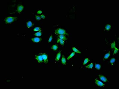 Polyclonal Rabbit anti-Human DPYSL2 / CRMP2 Antibody (IHC, IF, WB)
