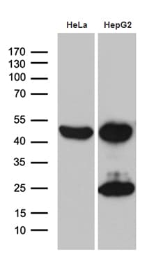 MCAD / ACADM Antibody (clone OTI10A5)