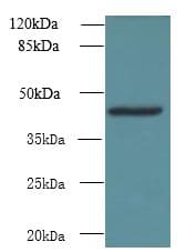 Polyclonal Rabbit anti-Human NSUN4 Antibody (IHC, WB)