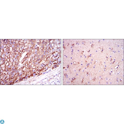 Monoclonal Mouse anti-Human APOE / Apolipoprotein E Antibody (IHC, WB)