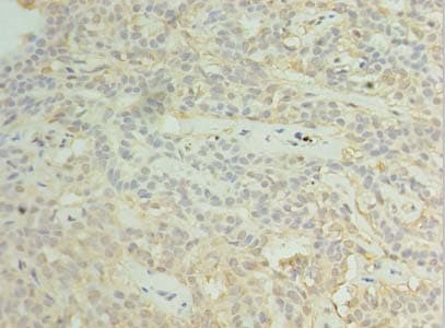 RBM11 Antibody