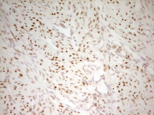 MEF2D Antibody (aa1-282, clone OTI3D12)