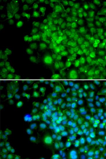 SLIM / FHL1 Antibody