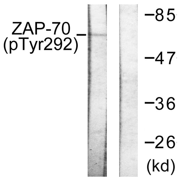 ZAP70 Antibody (phospho-Tyr292)