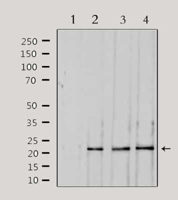 Polyclonal Rabbit anti-Human SOCS2 Antibody (IF, WB)