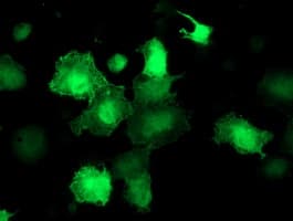 AKT1 Antibody (clone OTI3E3)