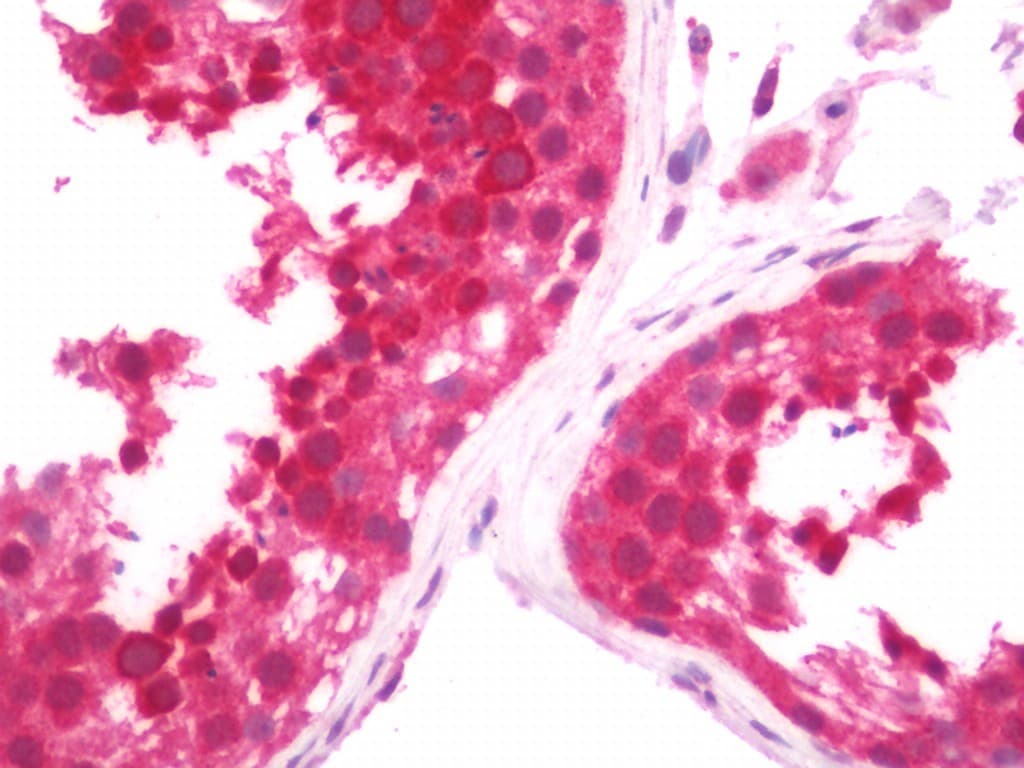 IHC-plus™ TRIP12 Antibody