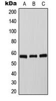 TH / Tyrosine Hydroxylase Antibody (phospho-Ser71)
